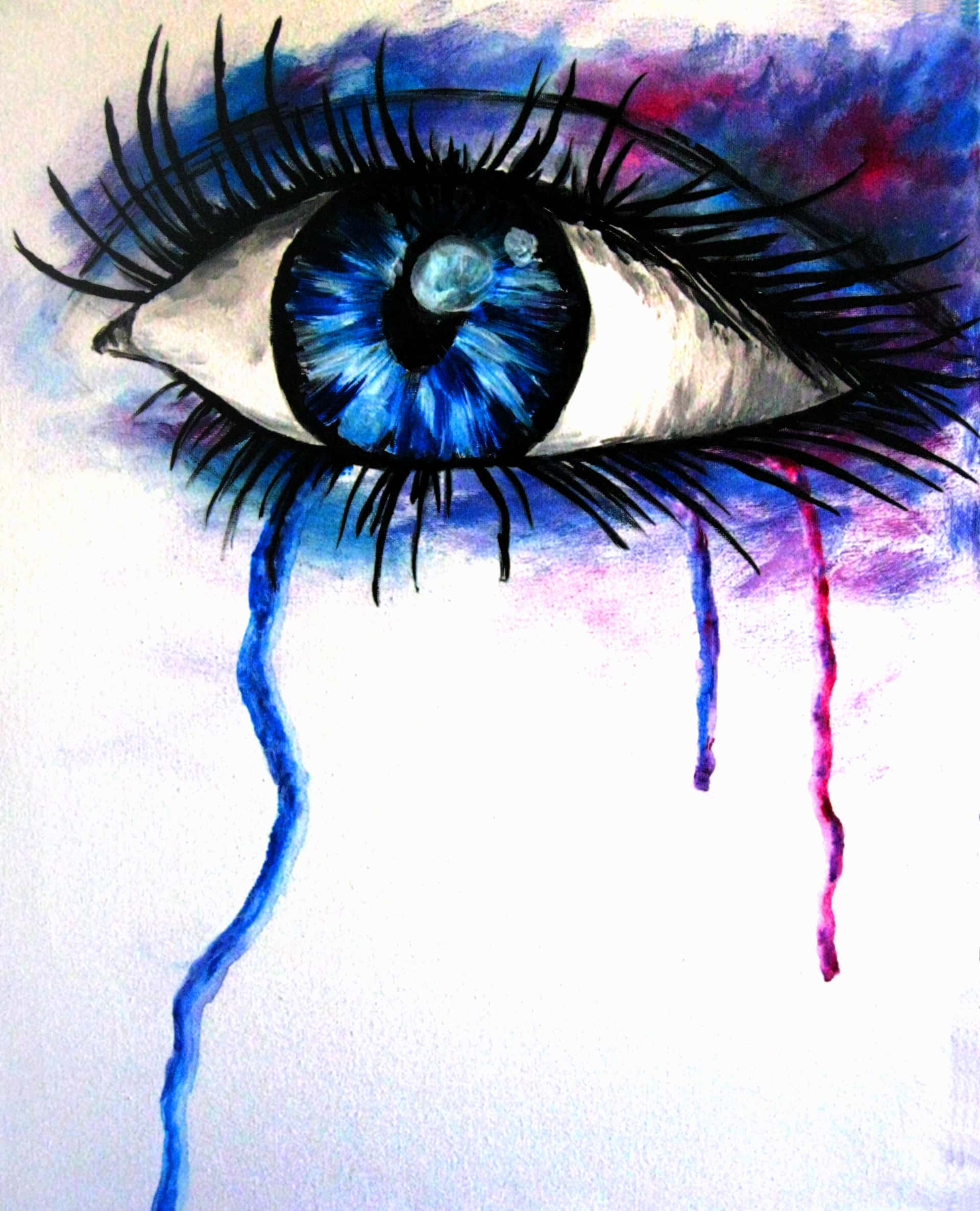 Watery Eyes